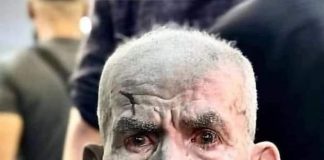 Pogled pun boli.. - featured image