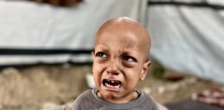 Preminuo petogodišnji dječak iz Gaze Abduallah Abu Zarqa: Njegov vapaj 'gladan sam' potresao svijet - featured image