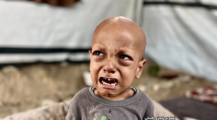 Preminuo petogodišnji dječak iz Gaze Abduallah Abu Zarqa: Njegov vapaj 'gladan sam' potresao svijet - featured image