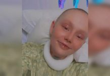 Ženi otpala koža nakon reakcije na lijek koji mnogi koriste: Ima 5 posto šansi za preživljavanje - featured image