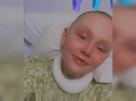 Ženi otpala koža nakon reakcije na lijek koji mnogi koriste: Ima 5 posto šansi za preživljavanje - featured image