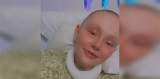 Ženi otpala koža nakon reakcije na lijek koji mnogi koriste: Ima 5 posto šansi za preživljavanje - featured image