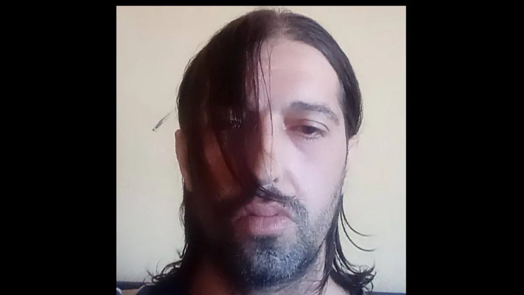 Eldin Dizdarević je napadač na medicinske sestre: Mjesecima im prijetio - featured image