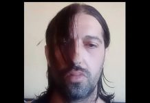 Eldin Dizdarević je napadač na medicinske sestre: Mjesecima im prijetio Eldin Dizdarević je napadač na medicinske sestre: Mjesecima im prijetio - featured image