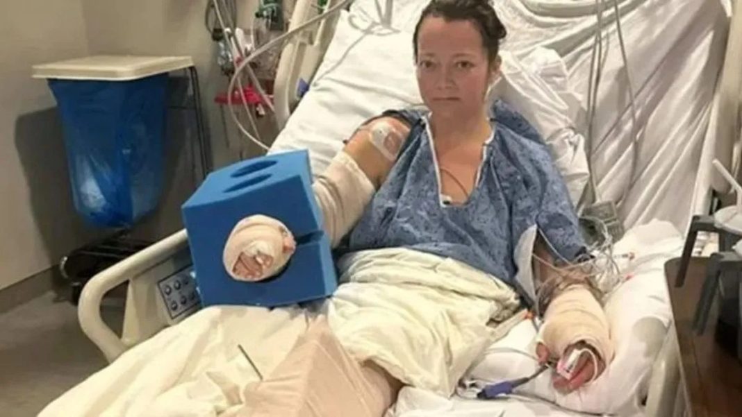 Ženi amputirali nogu nakon što je napao kućni pas! - featured image