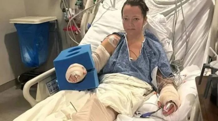 Ženi amputirali nogu nakon što je napao kućni pas! Ženi amputirali nogu nakon što je napao kućni pas! - featured image