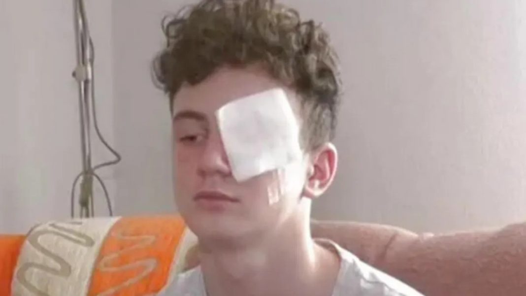 Ostao bez oka i prstiju zbog petarde! Nisam čuo ništa, onda su počeli da viču: 'Nemaš palac'! - featured image