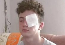 Ostao bez oka i prstiju zbog petarde! Nisam čuo ništa, onda su počeli da viču: ‘Nemaš palac’! Ostao bez oka i prstiju zbog petarde! Nisam čuo ništa, onda su počeli da viču: 'Nemaš palac'! - featured image